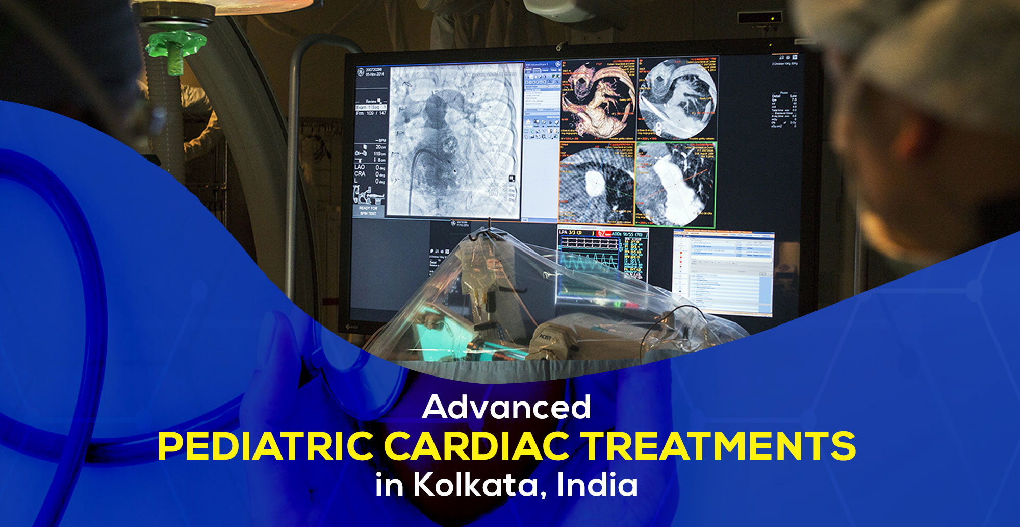 Advanced Pediatric Cardiac Treatments in Kolkata, India in 2024