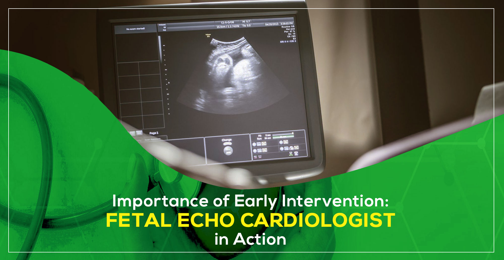 Importance of Early Intervention: Fetal Echo Cardiologist in Action