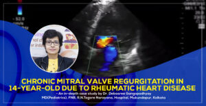 Chronic Mitral Valve Regurgitation in 14-Year-Old Due to Rheumatic Heart Disease by Dr. Debasree Gangopadhyay, best Padiatric Cardiologist in Kolkata