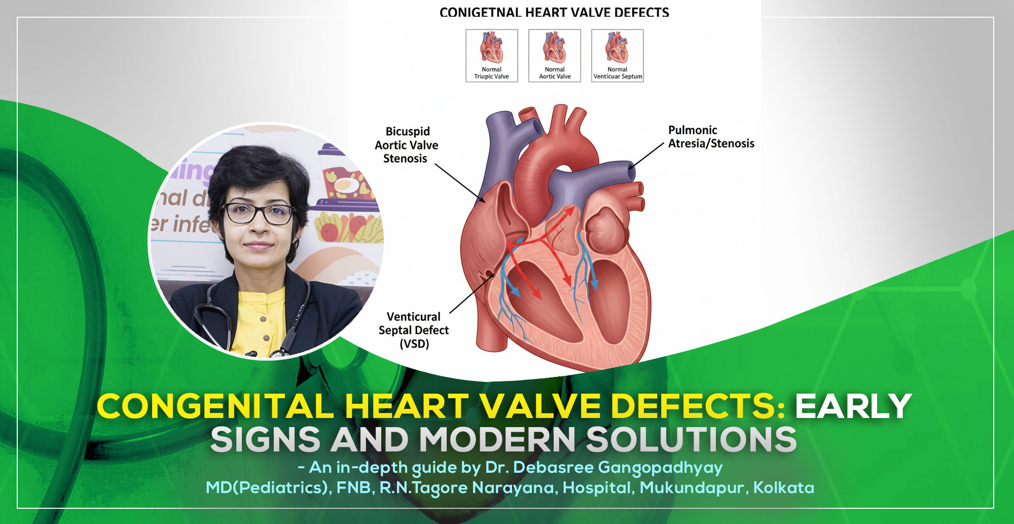 A detailed guide on ‘Congenital Heart Valve Defects: Early Signs and Modern Solutions’ by Dr. Debasree Gangopadhyay, pediatric cardiologist (MD), Narayana Hospital, Mukundapur, Kolkata