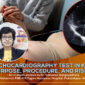 Fetal Echocardiography Test in Kolkata Purpose Procedure and Risks 85x85