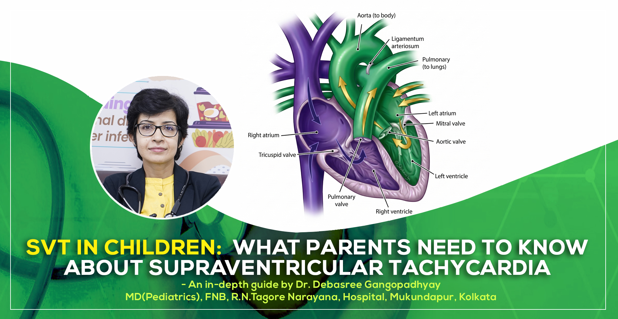 A detailed discussion on ‘SVT in Children: What Parents Need to Know About Supraventricular Tachycardia’ by Dr. Debasree Gangopadhyay, pediatric cardiologist (MD), Narayana Hospital, Mukundapur, Kolkata.